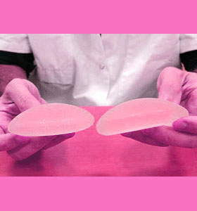 breast-implant-durability-1