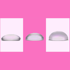 experiences with breast implants