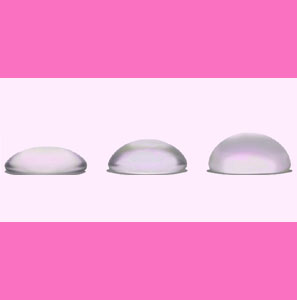 how-long-do-breast-implants-last-1